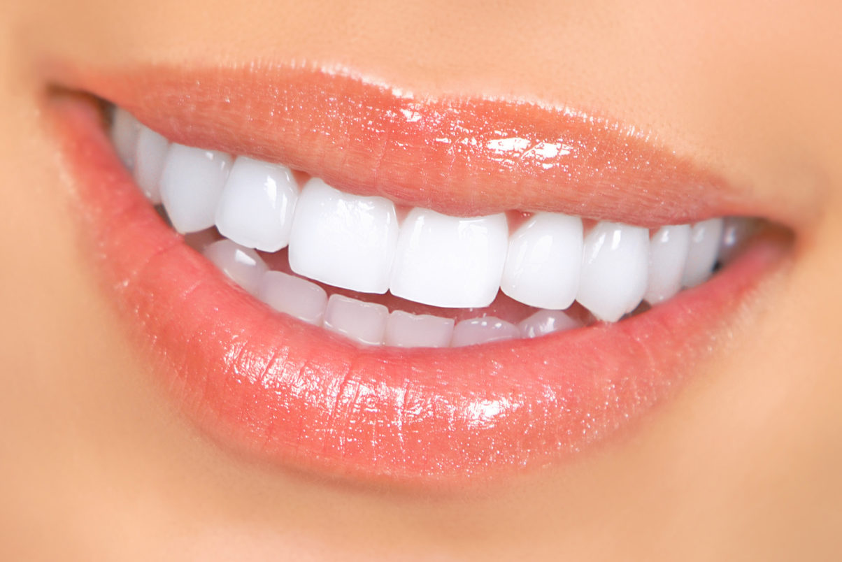 bigstock Woman Teeth 5143292 1204x804 1 Common Myths About Dental Bleaching Kits Debunked