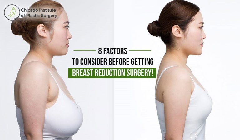 CIBlog 8FactorstoConsiderBeforeGettingBreastReductionSurgery Can Breast Reduction Help with Posture Problems?