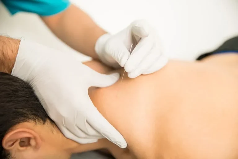 Depositphotos 210517906 xl 2015.jpg Pain Management Strategies: Dry Needling vs. Traditional Methods