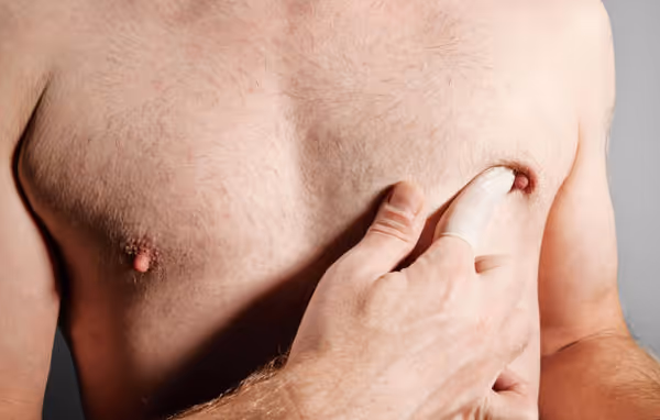 istockphoto 1352687117 612x612 1 Male Breast Cancer: Understanding Risk Factors and Causes