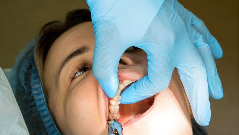 10 Warning Signs That Indicate You Should Consider Wisdom Teeth Removal 2 Expert Wisdom Tooth Extraction: What Patients Should Know