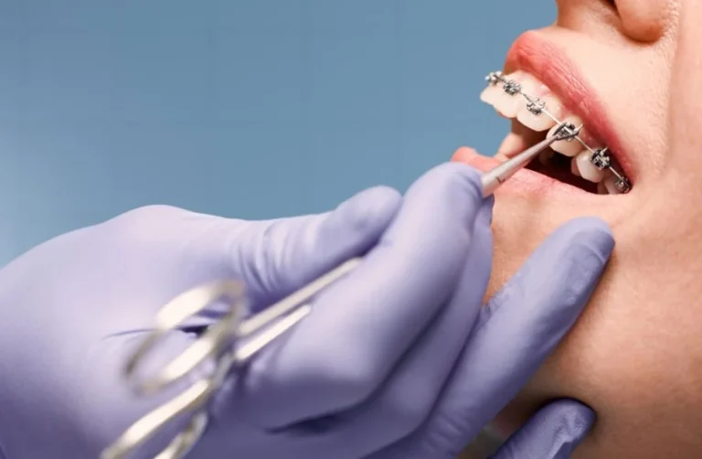How does orthodontic treatment impact facial aesthetics and symmetry img 900x588 1 The Connection Between Orthodontics and Facial Aesthetics