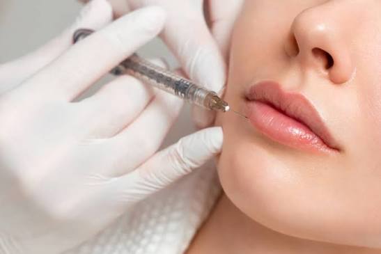 images 95 5 Reasons Modern 30-Somethings Are Pivoting to Biostimulatory Fillers Over Instant Volume