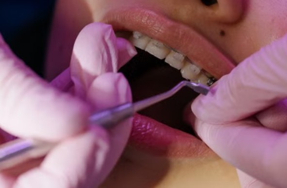 Screenshot 1014 A Practical Guide to Finding Affordable Braces in Singapore